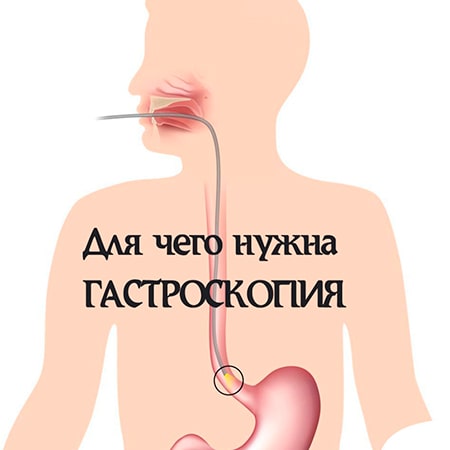 Консультация гастроэнтеролога в Алматы